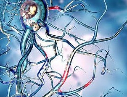 Stem Cell Trial to Target Huntington’s Disease
